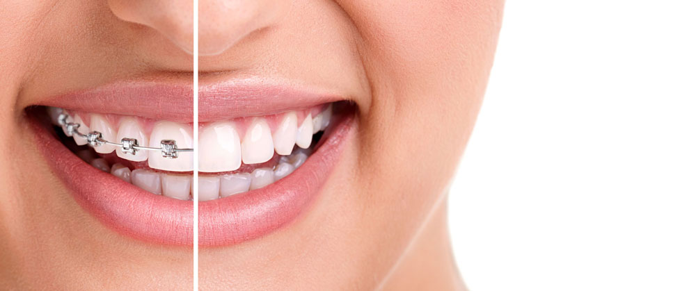 Dr Shabeer's Orthodontic Centre