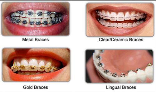 Dr Shabeer's Orthodontic Centre
